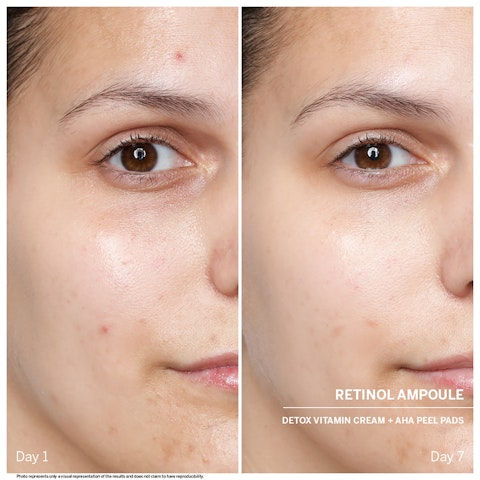 縮圖：Retinol Power Serum Ampoule 