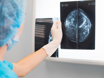 Four Common Coding Errors in Radiology