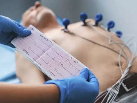 Eletrocardiograma