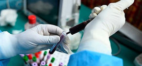 Blood test for many cancers show promising results 