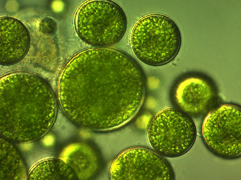 Unicellular green algae with large cells..jpg