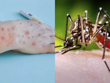Cartagena descarta casos de viruela sÃmica, pero se mantiene en alerta por aumento de dengue
