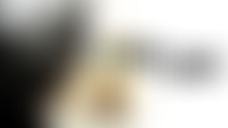 Dying Light: upgrade nextgen adesso disponibile anche per Xbox