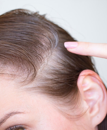 _woman has thin and weak hair.jpg