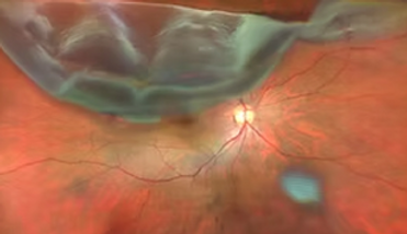 Rectangle 161124658.png