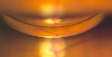 Rectangle 161124636 (4).png