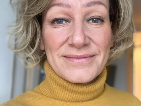 Story from an Alopecia Sufferer