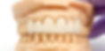 SuperT - Solid Zirconia_edited_edited.jpg