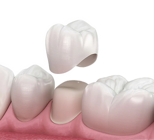 dental_crown_edited.png