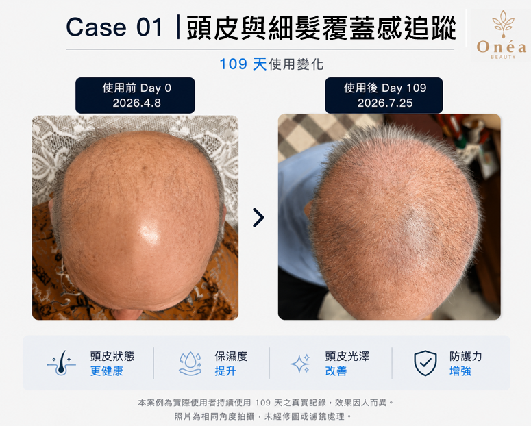 Case 01|109 天