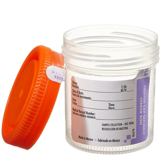 urine cup