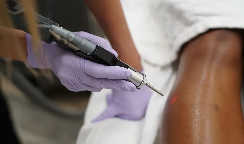 dark skinned woman receiving laser hair removal of the leg