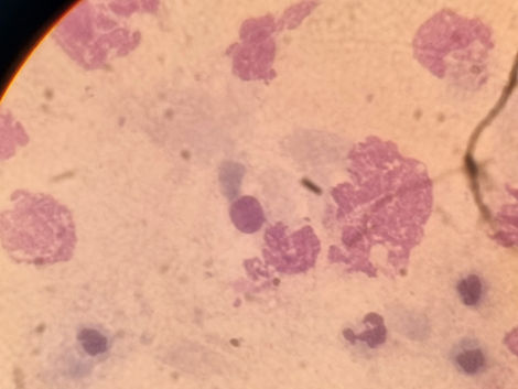 Citologia Uterina: Saiba quando sua égua está apresentando quadro de endometrite ou piometra por meio da avaliação microscópica de uma amostra uterina. Essa avaliação permite direcionar o diagnóstico definitivo, viabilizando as corretas medidas para tratamento. 