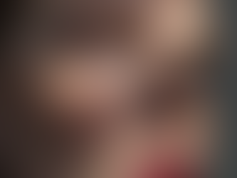 Peau [Peau naturelle avec nombreuses taches de rousseur visibles.]