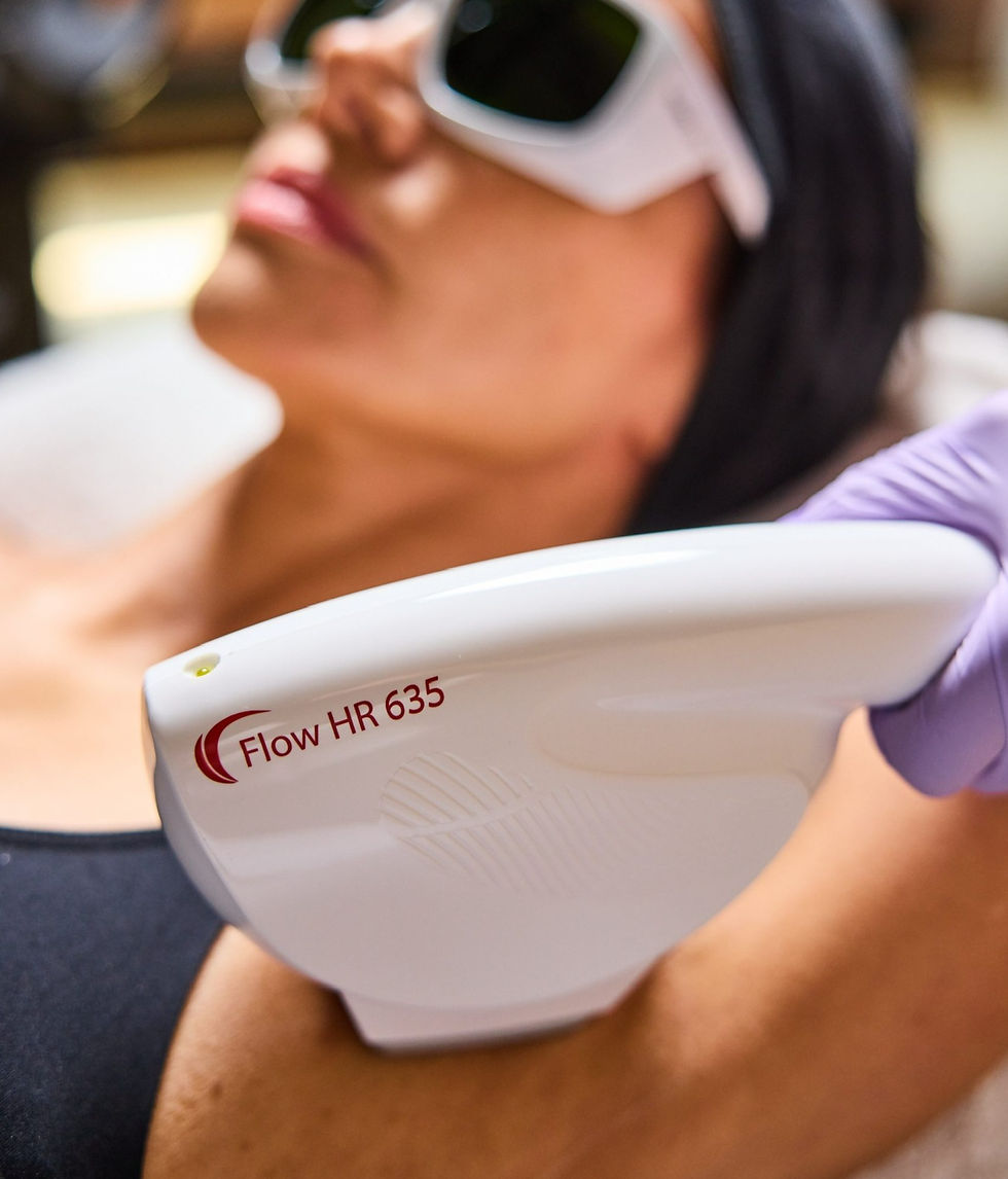 laser hair removal