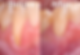 Before+After.001-4a099c0e-1920w.webp