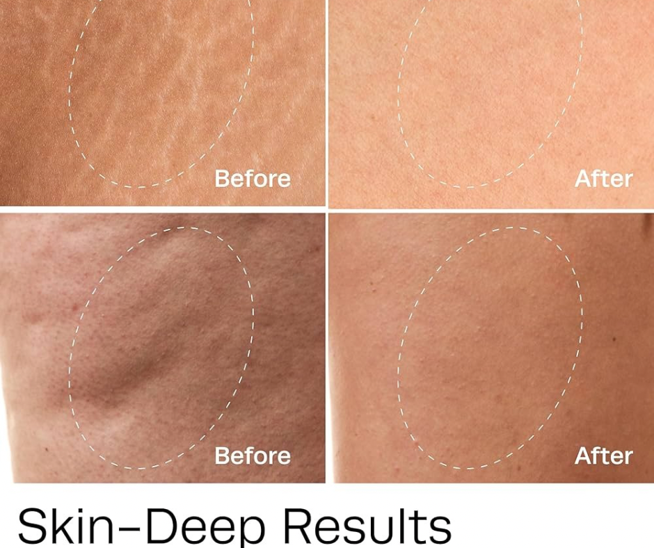 Thumbnail: Cellulite Hot Vita Vitamin C Body Serum Roll On