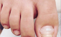 BS Brace - Image.jpg