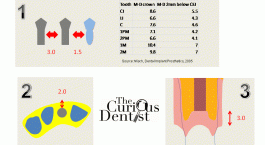 The Chairside Implant Space Planning Guide