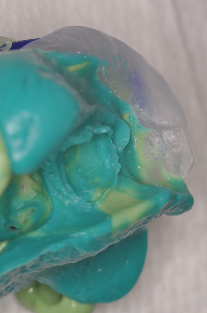 Three Triple Tray Tips for Better Impressions