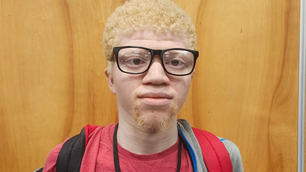 Celebrating Resilience and Dedication: Spotlight on Matthew Watson