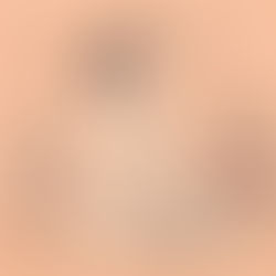 Managing Menopausal Symptoms with Acupuncture in Oxford, UK