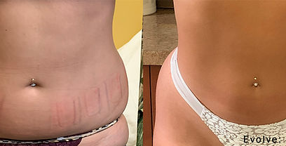 evolve-before-after-dr-c-sugihara-preview-1.jpg