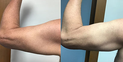 evolve-before-after-dr-d-werner-preview-1.jpg