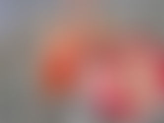 Acapulco, Zihuatanejo y La Unión entre los municipios con casos de tosferina