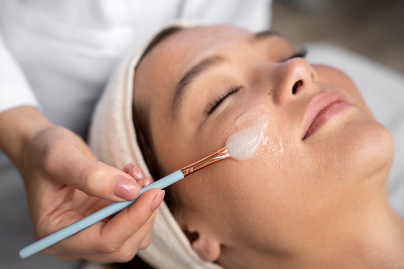 Chemical Peel Preston	
