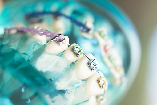 close-up-artificial-teeth(1).jpg