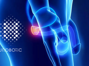 Une nouvelle sous-catégorie de cancer de la prostate identifiée par des chercheurs de renom