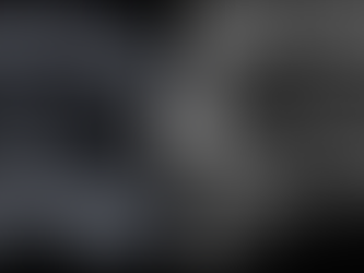 Biopsies prostatiques par fusion d'image