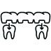 dental bridge