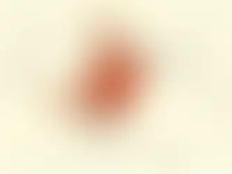 Carcinization: Introduction to the Hallmarks of Cancer