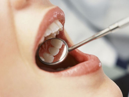 Dental check-up with mirror examining healthy molars.