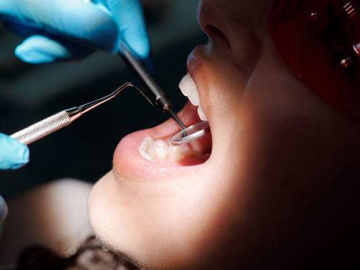 Dentist in blue gloves examining a patient's teeth with tools. Bright dental light highlights teeth. Patient wears protective glasses.