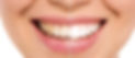 Before and after dental whitening image