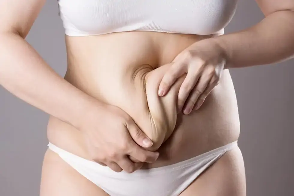 sagging-belly-1-.webp