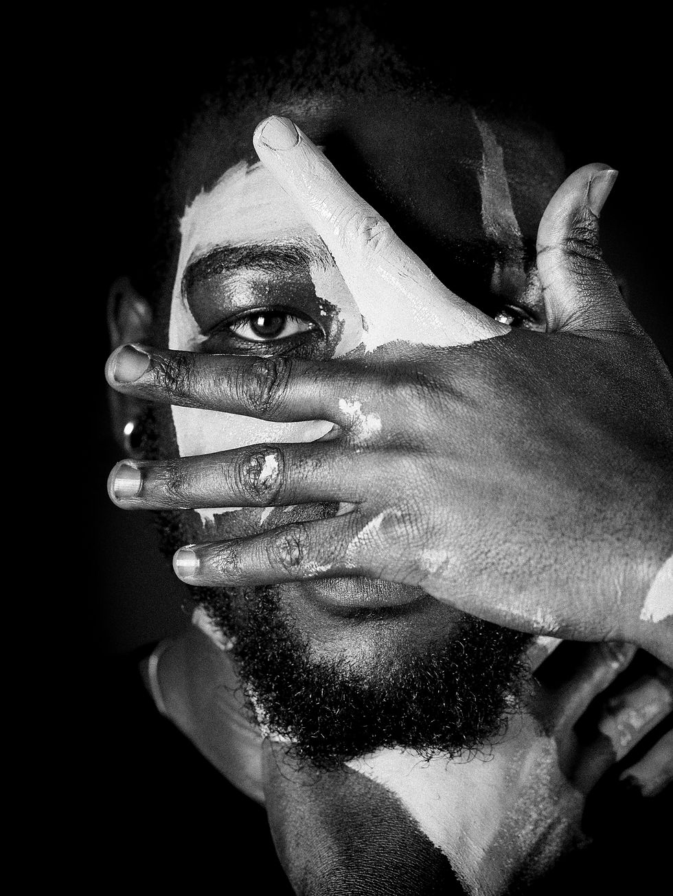 man covering his face