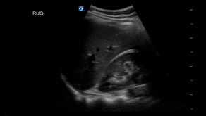 Radiology #9: Pulling a FAST one