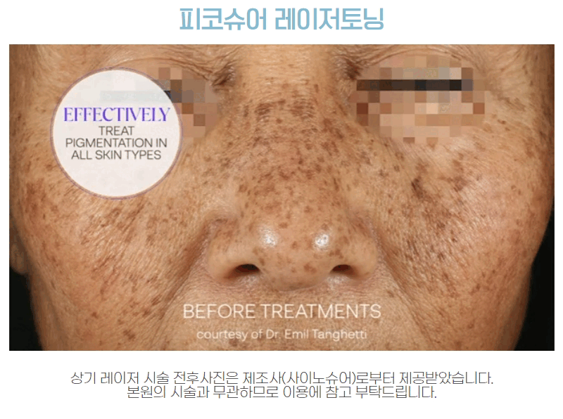 닥터윤의_피부톡톡_(5).gif