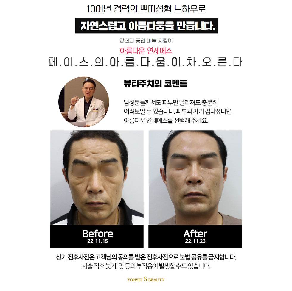 필러랜딩 (5).jpg