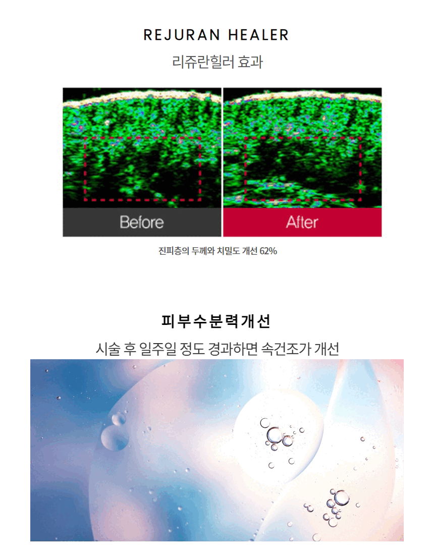 상세페이지 (2).gif