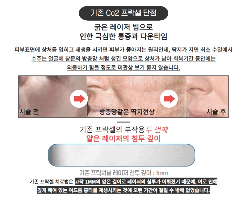 모두 여드름흉터 (1).gif