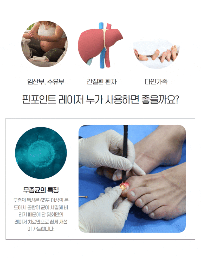 水虫治療.gif