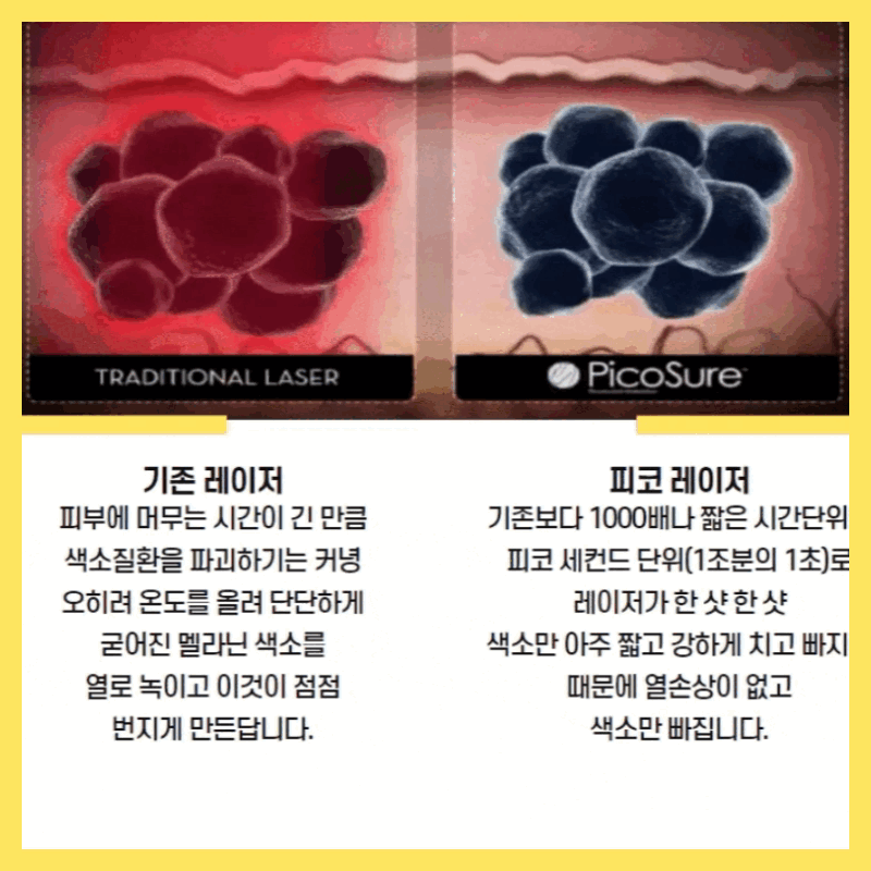 복사본_피코토닝_(1) (3).gif