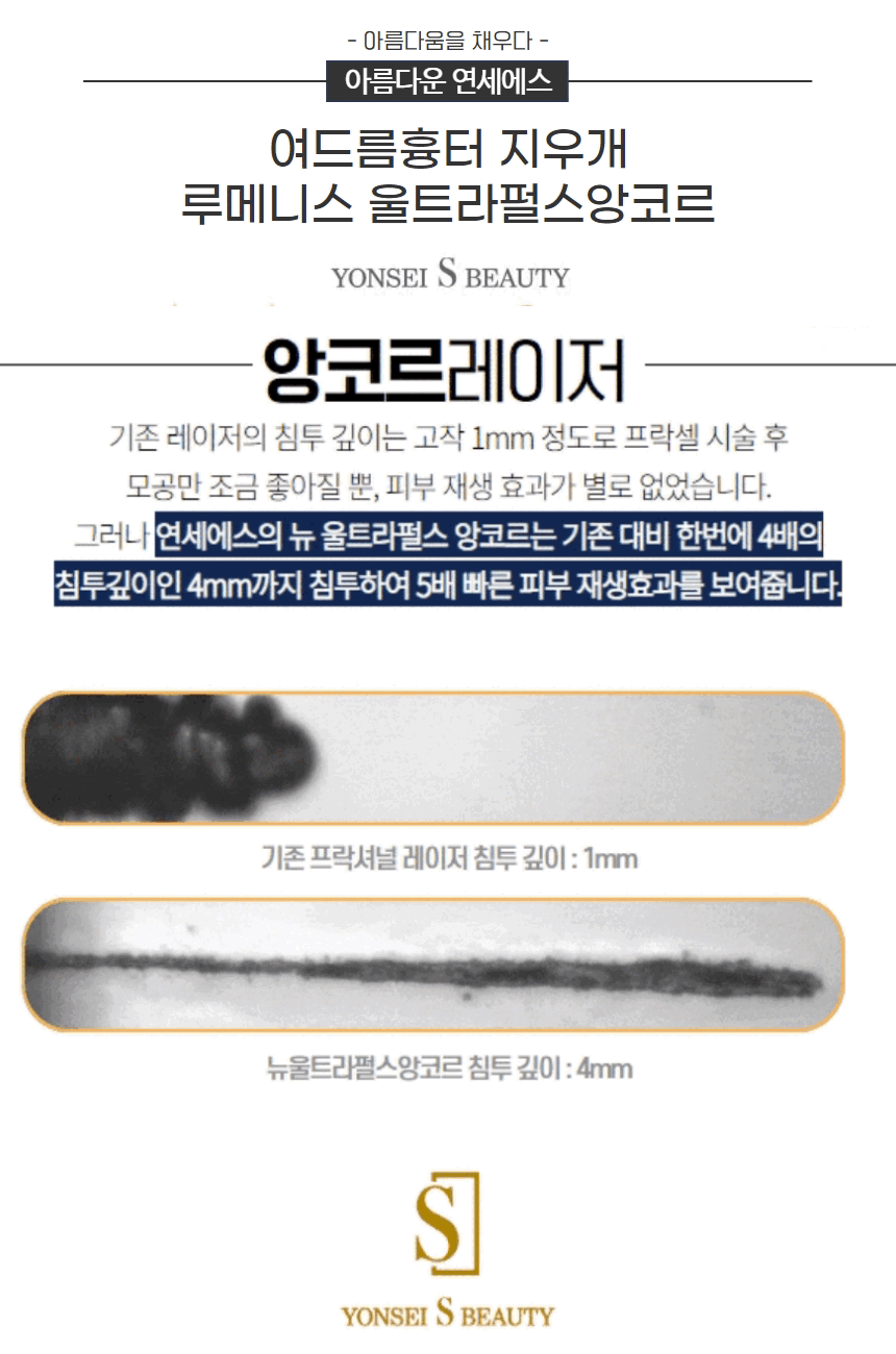 여드름&흉터치료 (1).gif