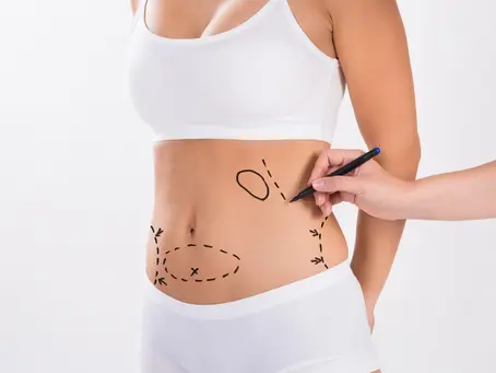 Medical Options for Weight Loss