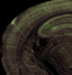Measured vector transduction efficiency across a mouse brain